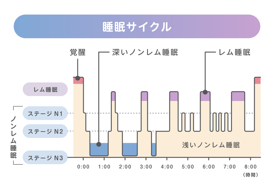 一晩の睡眠でレム睡眠とノンレム睡眠(ステージN1〜N3)が周期的に繰り返される睡眠サイクルのグラフ
